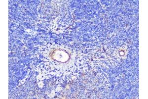 IHC analysis of INPPL1 using anti-INPPL1 antibody (ABIN6719492). (INPPL1 抗体  (AA 1172-1258))