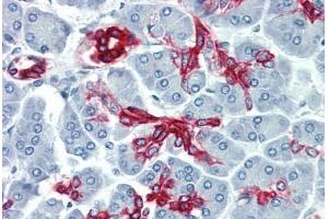 Human Pancreas (formalin-fixed, paraffin-embedded) stained with KRT19 antibody ABIN396943 at 10 ug/ml followed by biotinylated anti-mouse IgG secondary antibody ABIN481714, alkaline phosphatase-streptavidin and chromogen. (Cytokeratin 19 抗体)