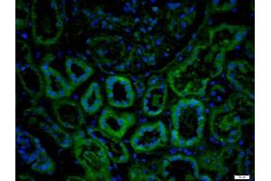Immunofluorescence (Paraffin-embedded Sections) (IF (p)) image for anti-Interleukin 1 Receptor, Type II (IL1R2) (AA 301-398) antibody (ABIN747758)