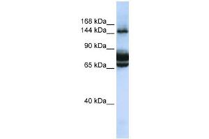 FAM83B antibody used at 1 ug/ml to detect target protein. (FAM83B 抗体  (C-Term))