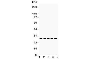 Western blot testing of ERAB antibody and Lane 1:  mouse lung (HSD17B10 抗体  (AA 48-261))