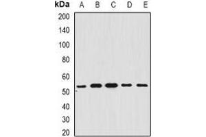 Western blot analysis of BAR expression in A549 (A), SHSY5Y (B), mouse brain (C), mouse liver (D), rat heart (E) whole cell lysates. (BFAR 抗体)