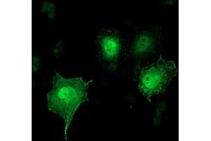 Anti-SH2D2A mouse monoclonal antibody (ABIN2455606) immunofluorescent staining of COS7 cells transiently transfected by pCMV6-ENTRY SH2D2A (RC204162). (SH2D2A 抗体)