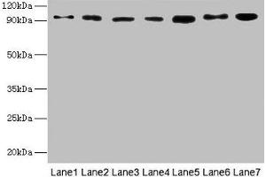 Western blot All lanes: USP5 antibody at 10 μg/mL Lane 1: Mouse brain tissue Lane 2: A549 whole cell lysate Lane 3: MCF-7 whole cell lysate Lane 4: A375 whole cell lysate Lane 5: U251 whole cell lysate Secondary Goat polyclonal to rabbit IgG at 1/10000 dilution Predicted band size: 96, 94 kDa Observed band size: 96 kDa (USP5 抗体  (C-Term))