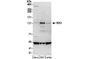 anti-Salt-Inducible Kinase 2 (SIK2) (AA 600-650) antibody