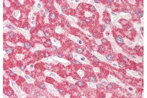 Rabbit Anti-TXN2 antibody Catalog Number: ARP54909 Formalin Fixed Paraffin Embedded Tissue: Human Liver Primary antibody Concentration: 1:100 Secondary Antibody: Donkey anti-Rabbit-Cy3 Secondary Antibody Concentration: 1:200 Magnification: 20x Exposure Time: 0. (TXN2 抗体  (Middle Region))