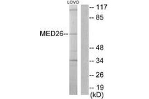 Western blot analysis of extracts from LOVO cells, using MED26 Antibody.