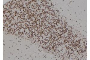 Immunohistochemistry (IHC) image for anti-Proteasome (Prosome, Macropain) 26S Subunit, ATPase, 4 (PSMC4) (C-Term) antibody (ABIN6264481)
