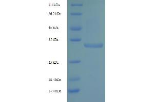 SDS-PAGE (SDS) image for Killer Cell Lectin-Like Receptor Subfamily C, Member 2 (KLRC2) (AA 94-231) protein (His-SUMO Tag) (ABIN5709817)