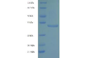 SDS-PAGE (SDS) image for Killer Cell Lectin-Like Receptor Subfamily C, Member 2 (KLRC2) (AA 94-231) protein (His-SUMO Tag) (ABIN4974284) (KLRC2 Protein (AA 94-231) (His-SUMO Tag))