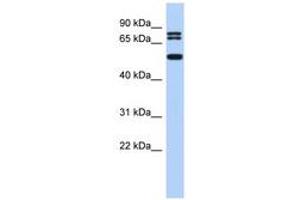 Image no. 1 for anti-Ceramide Synthase 4 (CERS4) (N-Term) antibody (ABIN6742880) (LASS4 抗体  (N-Term))