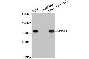Immunoprecipitation analysis of 200ug extracts of 293T cells using 1ug MNAT1 antibody. (MNAT1 抗体)