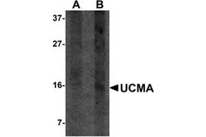 Western Blotting (WB) image for anti-Upper Zone of Growth Plate and Cartilage Matrix Associated (UCMA) (C-Term) antibody (ABIN1030790) (UCMA 抗体  (C-Term))