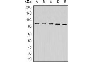 Western blot analysis of USP10 expression in HepG2 (A), A549 (B), mouse liver (C), mouse kidney (D), rat brain (E) whole cell lysates. (USP10 抗体)