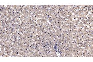 Detection of ANXA3 in Human Liver Tissue using Monoclonal Antibody to Annexin A3 (ANXA3) (Annexin A3 抗体  (AA 190-312))
