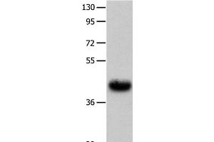 Western Blot analysis of Human fetal muscle tissue using UTS2R Polyclonal Antibody at dilution of 1:400 (UTS2R 抗体)