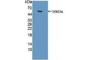 Detection of Recombinant USP7, Human using Polyclonal Antibody to Ubiquitin Specific Peptidase 7 (USP7) (USP7 抗体  (AA 54-507))