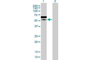 Western Blot analysis of ZNF358 expression in transfected 293T cell line by ZNF358 MaxPab polyclonal antibody. (ZNF358 抗体  (AA 1-481))