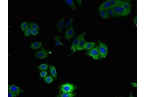 Immunofluorescent analysis of HepG2 cells using ABIN7144499 at dilution of 1:100 and Alexa Fluor 488-congugated AffiniPure Goat Anti-Rabbit IgG(H+L) (Aquaporin 1 抗体  (AA 220-269))