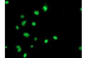 Anti-GATM mouse monoclonal antibody (ABIN2454803) immunofluorescent staining of COS7 cells transiently transfected by pCMV6-ENTRY GATM (RC200474). (GATM 抗体)