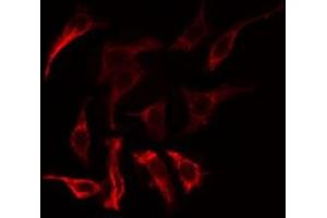 ABIN6275177 staining COLO205  cells by IF/ICC. (GNAT1 抗体  (Internal Region))