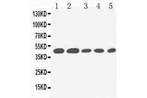 Anti-IL2 Receptor gamma antibody, Western blotting Lane 1: PANC Cell Lysate Lane 2: HELA Cell Lysate Lane 3: JURKAT Cell Lysate Lane 4: RAJI Cell Lysate Lane 5: CEM Cell Lysate (IL2RG 抗体  (Middle Region))