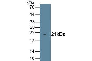 Detection of Recombinant IHH, Human using Polyclonal Antibody to Hedgehog Homolog, Indian (IHH) (Indian Hedgehog 抗体  (AA 45-195))