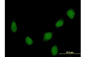 Immunofluorescence of purified MaxPab rabbit antibody to HOXB7 on HeLa cell.