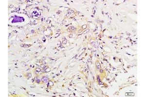 Immunohistochemistry (Paraffin-embedded Sections) (IHC (p)) image for anti-Tumor Susceptibility Gene 101 (TSG101) (AA 4-120) antibody (ABIN685507)