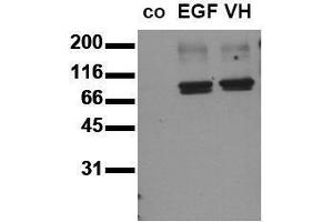 Western Blotting (WB) image for anti-Signal Transducer and Activator of Transcription 3 (Acute-Phase Response Factor) (STAT3) (pTyr705) antibody (ABIN126898) (STAT3 抗体  (pTyr705))