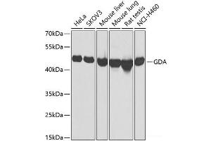 Western blot analysis of extracts of various cell lines using GDA Polyclonal Antibody at dilution of 1:1000. (GDA 抗体)