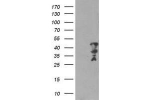Western Blotting (WB) image for anti-Myeloid Leukemia Factor 2 (MLF2) antibody (ABIN1499501) (MLF2 抗体)