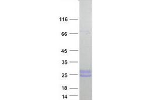 Western Blotting (WB) image for Collagen, Type X (COL10) protein (Myc-DYKDDDDK Tag) (ABIN2712430)