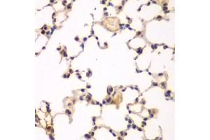 Immunohistochemistry of paraffin-embedded rat lung using NFKBIB antibody (ABIN6130475, ABIN6144584, ABIN6144585 and ABIN6221459) at dilution of 1:200 (40x lens). (NFKBIB 抗体  (AA 1-356))