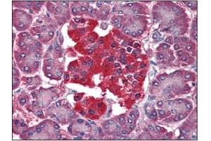 Immunohistochemistry (IHC) image for anti-14-3-3 theta (YWHAQ) (AA 1-245), (N-Term) antibody (ABIN336110) (14-3-3 theta 抗体  (N-Term))
