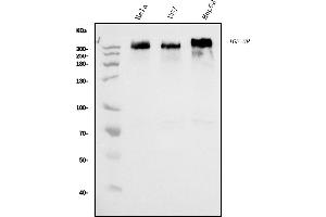 Western blot analysis of IGF2R using anti-IGF2R antibody (ABIN7601706).