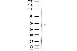 anti-Ubiquitin-Like Modifier Activating Enzyme 3 (UBA3) (Internal Region) antibody