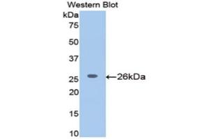 Western Blotting (WB) image for anti-Meningioma Expressed Antigen 5 (Hyaluronidase) (MGEA5) (AA 19-222) antibody (ABIN1172151) (MGEA5 抗体  (AA 19-222))
