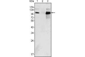Western blot analysis using Androgen receptor mouse mAb against K562 (1), Jurkat (2) and LNCaP (3) cell lysate. (Androgen Receptor 抗体)