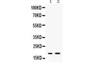 Western blot analysis of Peptide YY expression in mouse spleen extract ( Lane 1) and mouse liver extract ( Lane 2). (Peptide YY 抗体  (Middle Region))