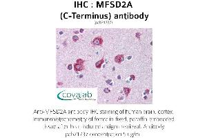 Image no. 2 for anti-Major Facilitator Superfamily Domain Containing 2A (MFSD2A) (C-Term) antibody (ABIN1736932)