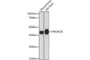Western blot analysis of extracts of various cell lines, using PRKB Rabbit mAb (ABIN7269663) at 1:1000 dilution. (PRKAR2B 抗体)