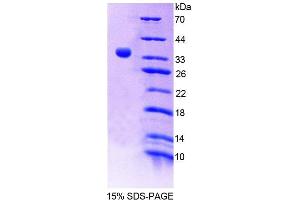 SDS-PAGE analysis of Mouse BPNT1 Protein. (BPNT1 蛋白)