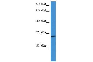 Western Blot showing CFD antibody used at a concentration of 1-2 ug/ml to detect its target protein. (Adipsin 抗体  (C-Term))