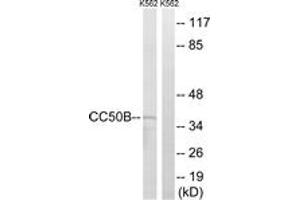 Western blot analysis of extracts from K562 cells, using TMEM30B Antibody. (TMEM30B 抗体  (AA 91-140))