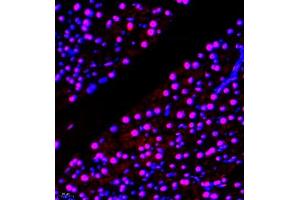 Immunofluorescence (Paraffin-embedded Sections) (IF (p)) image for anti-General Transcription Factor IIIC, Polypeptide 2, beta 110kDa (GTF3C2) antibody (ABIN7074038)