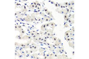 Immunohistochemistry of paraffin-embedded human stomach using CBX1 antibody (ABIN5971253) at dilution of 1/100 (40x lens). (CBX1 抗体)