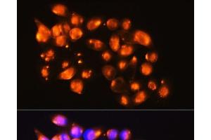 Immunofluorescence analysis of HeLa cells using EPB41L2 Polyclonal Antibody at dilution of 1:100. (EPB41L2 抗体)