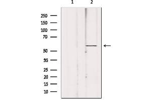 Western blot analysis of extracts from 293, using ACBD5 Antibody. (ACBD5 抗体  (Internal Region))