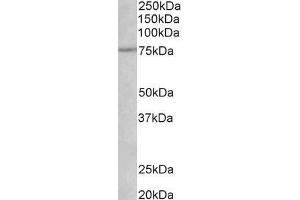 ABIN870688 (1µg/ml) staining of Rat Heart lysate (35µg protein in RIPA buffer). (NGFR 抗体  (AA 202-215))